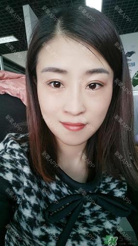 埋线双眼皮能保持多久？埋线双眼皮是永久吗