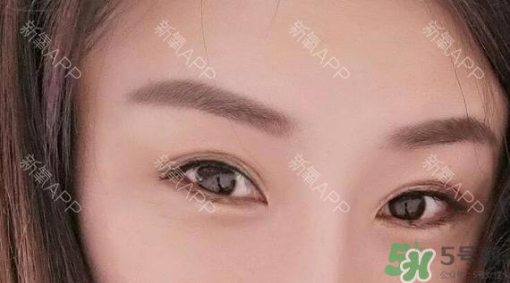 埋线双眼皮能保持多久？埋线双眼皮是永久吗
