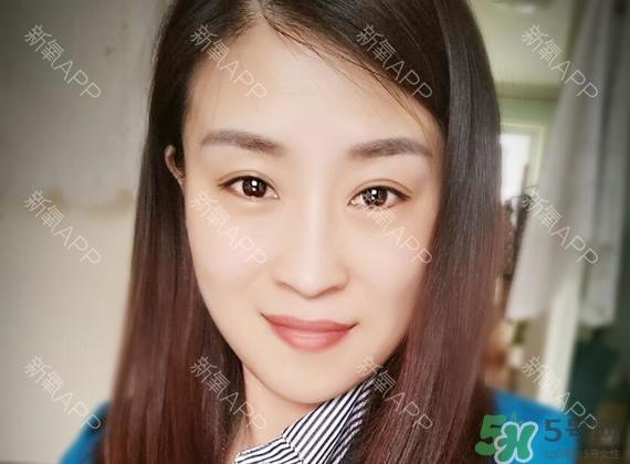 埋线双眼皮能保持多久？埋线双眼皮是永久吗