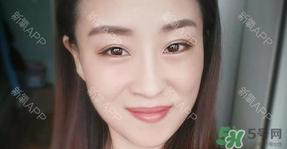 埋线双眼皮能保持多久？埋线双眼皮是永久吗