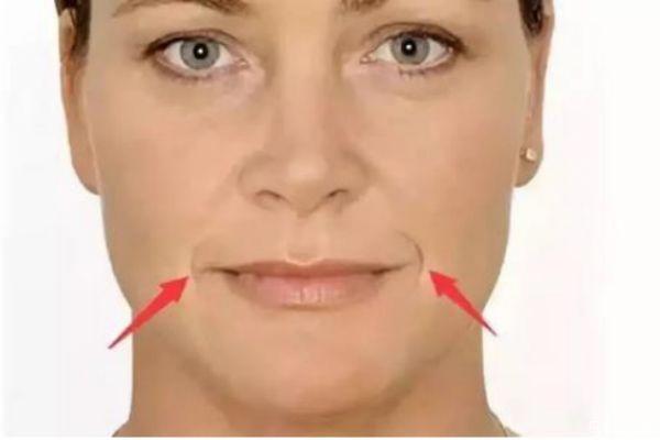 如何去除法令纹 去除法令纹的方法