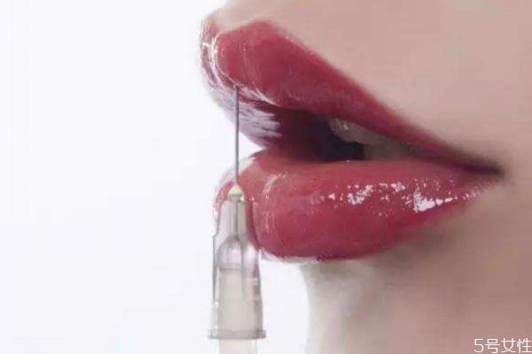 打玻尿酸痛可以接受吗 打玻尿酸有多痛