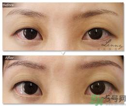 眉毛怎么整形好看？眉毛怎么整自然？