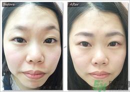 眉毛怎么整形好看？眉毛怎么整自然？