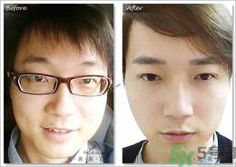 眉毛怎么整形好看？眉毛怎么整自然？