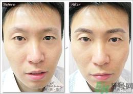 眉毛怎么整形好看？眉毛怎么整自然？