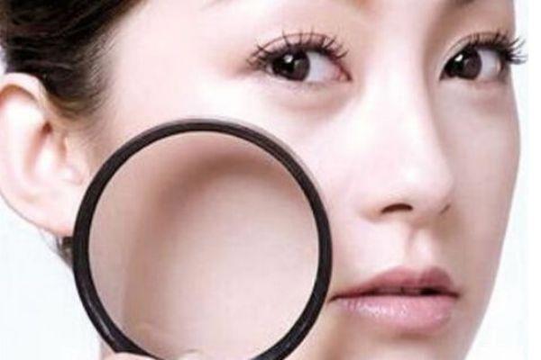 脸上的毛孔为什么会变大 毛孔为什么会变粗