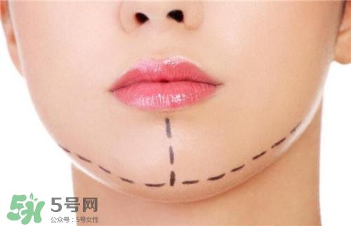 玻尿酸垫下巴能维持多久？玻尿酸垫下巴能维持多长时间？