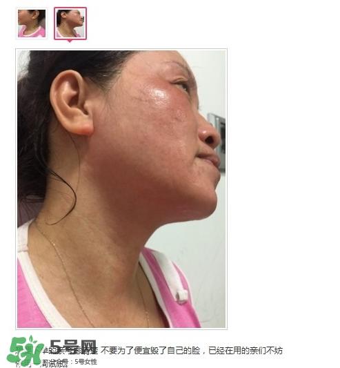 肌肤之食是什么牌子？肌肤之食让我毁容了