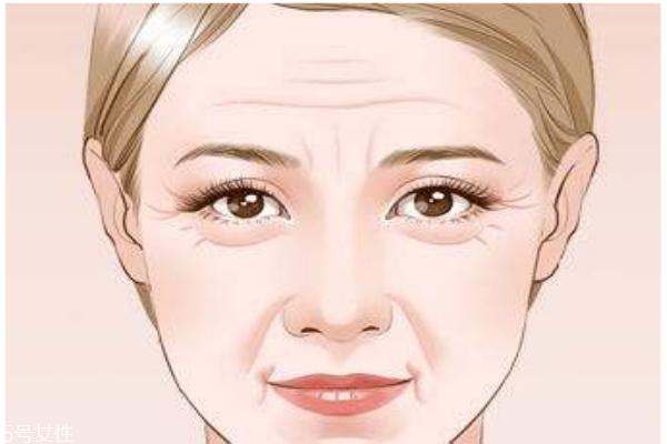 抬头纹怎么去除?小妙招教给你