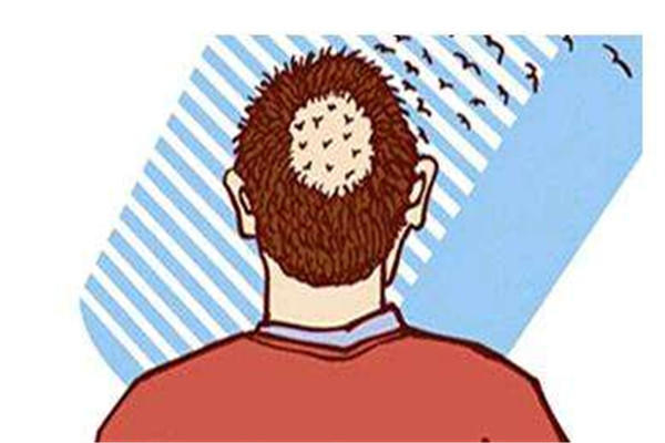 植发有危害吗 植发有用吗