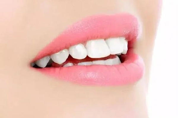 武汉美白牙齿去哪里好 武汉美白牙齿多少钱