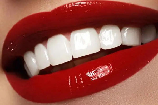 武汉美白牙齿去哪里好 武汉美白牙齿多少钱