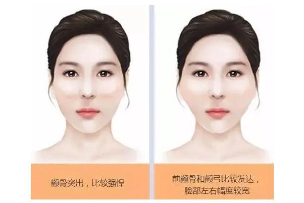 颧骨内推手术多少钱啊 颧骨内推后遗症