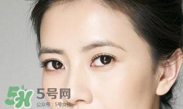 欧式双眼皮适合什么人 欧式双眼皮前后对比