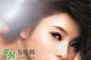 欧式双眼皮适合什么人 欧式双眼皮前后对比