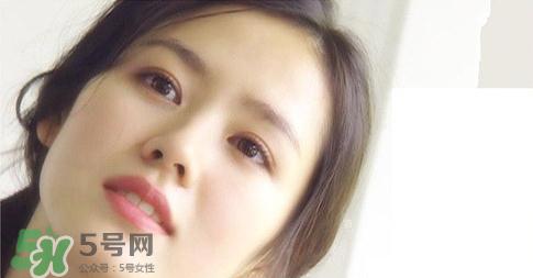 欧式双眼皮适合什么人 欧式双眼皮前后对比