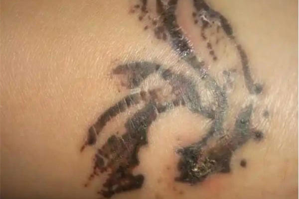 洗纹身一般要洗几次才能干净 洗纹身可以完全洗掉吗