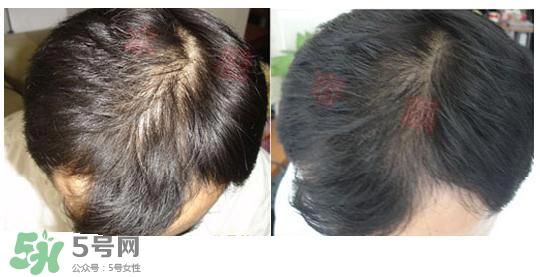 资生堂不老林洗发水怎么样？资生堂不老林洗发水能长头发吗