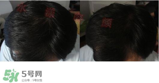 资生堂不老林洗发水怎么样？资生堂不老林洗发水能长头发吗