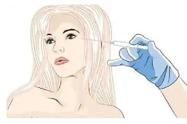 胶原蛋白填充眼窝凹陷保持多久 胶原蛋白填充脸部安全吗