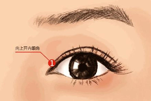 武汉双眼皮埋线哪家医院最好 武汉双眼皮埋线价格