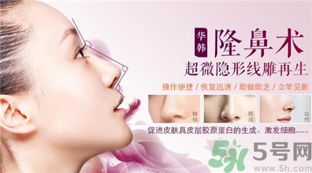 线雕隆鼻是什么?线雕隆鼻可以保持多久?