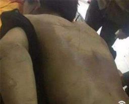 泸州太伏中学学生死亡，死因疑点重重