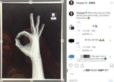 ladygaga宣布分手,于社交平台宣布自己单身!