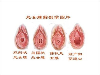 处女膜图片赏析:真实完美的处女膜高清大图