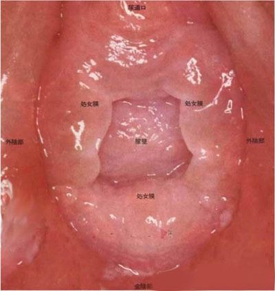 处女膜图片赏析：真实完美的处女膜高清大图