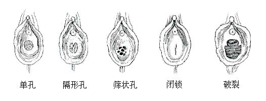 美女阴道图的样子 史上最真实的女人阴道图片