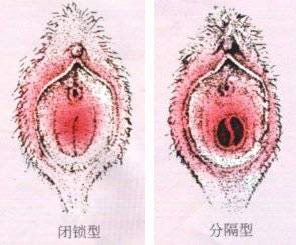 美女阴道图的样子 史上最真实的女人阴道图片