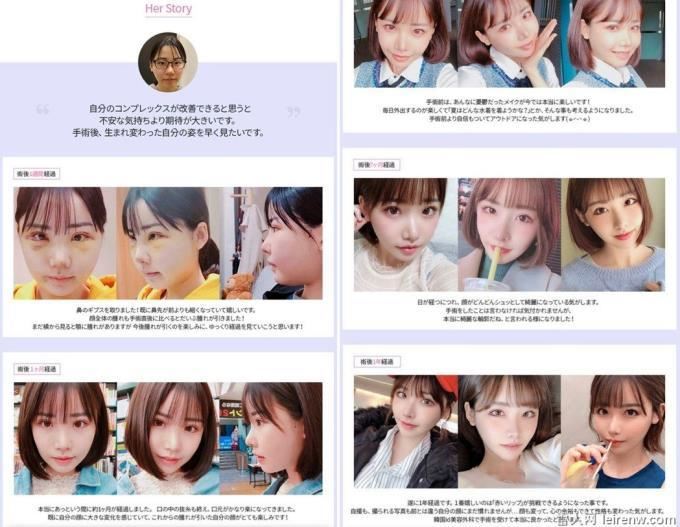 向明日花看齐!深田咏美整容、人工美女突袭暗黑界