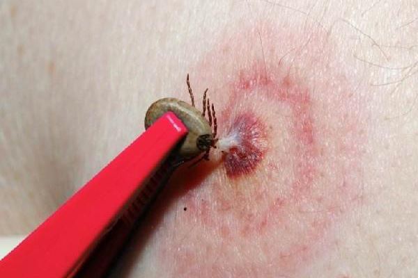 十大吸血昆虫 都是传染病的中间宿主