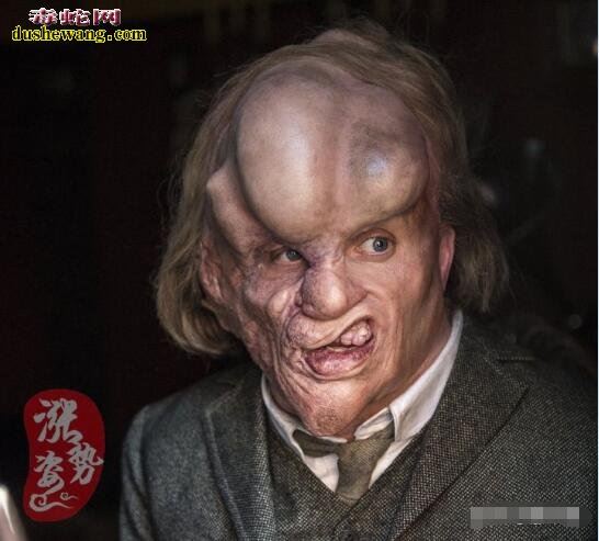 世界上最恐怖的10种人 全球十大恐怖畸形人(真实图片)