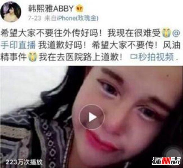 风油精事件 女主播往下体滴风油精（疼痛不止前往医院）
