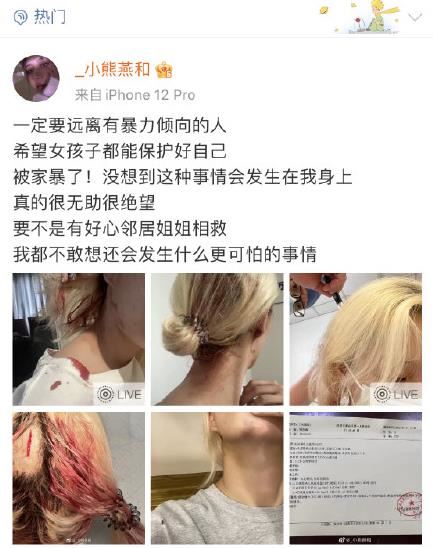 刘俣呈家暴小熊燕和视频画面GIF，家暴原因曝光