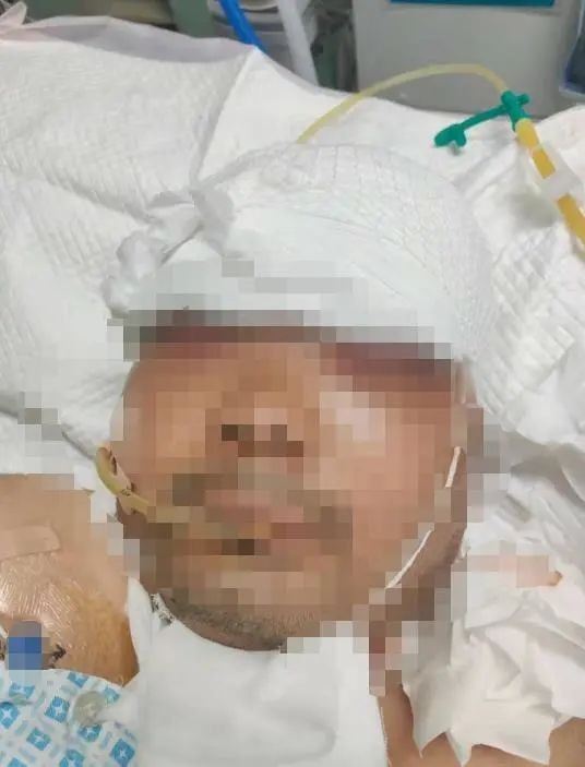 惨剧!银川一男子给轮胎充气发生爆炸,头部血肉模糊左眼爆裂