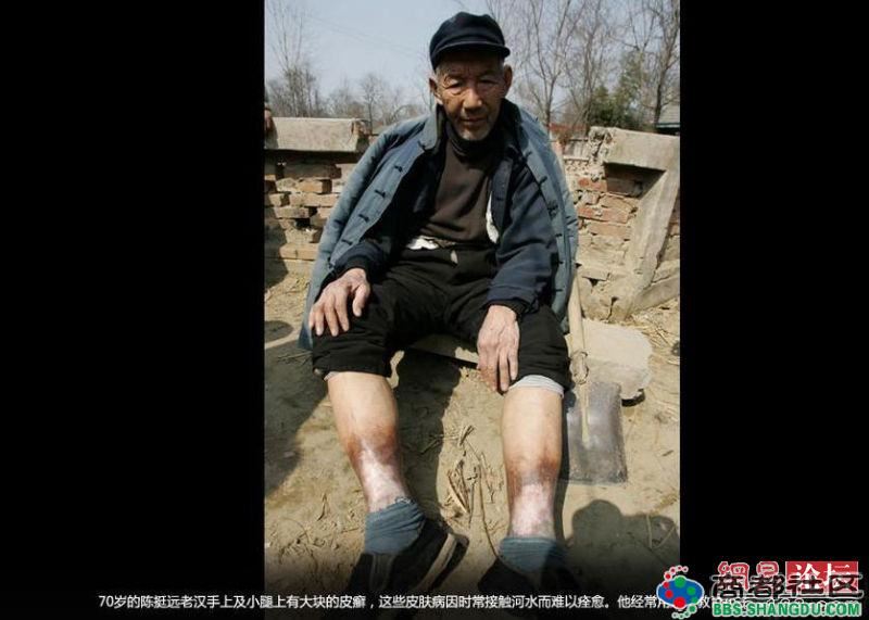 走进河南癌症村 富人制造的污染穷人买单！（图组）