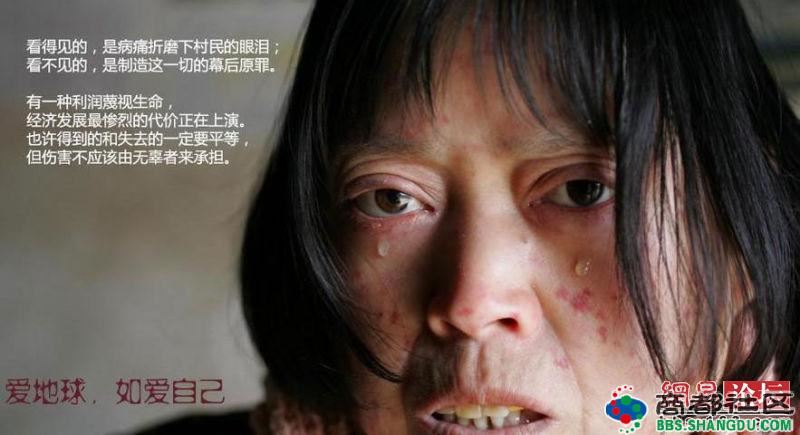 走进河南癌症村 富人制造的污染穷人买单！（图组）
