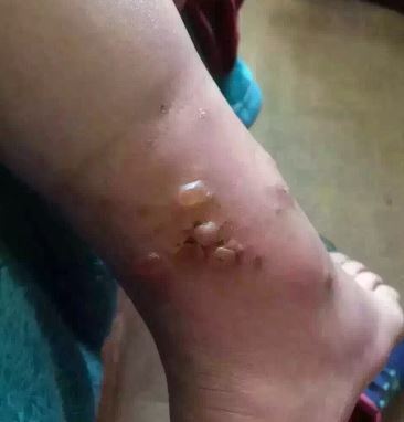 林妙可“无缘北电”难道是因为她的身高？