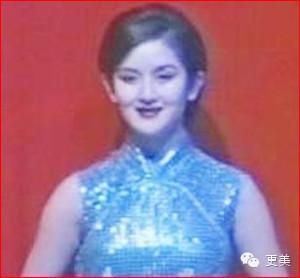 谢娜整容前后对比照曝光（图）