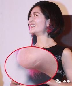 谢娜整容前后对比照曝光（图）