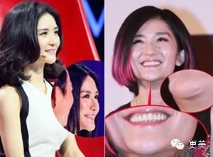 谢娜整容前后对比照曝光（图）