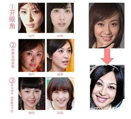 黄晓明旧爱李菲儿:屡次整容曾遭封杀（图）