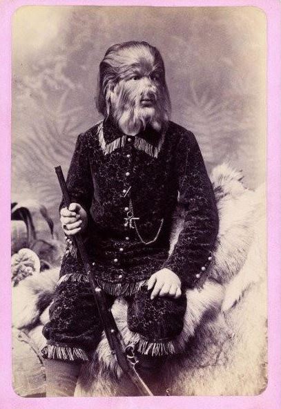 真实历史证明，近亲结婚后果很严重