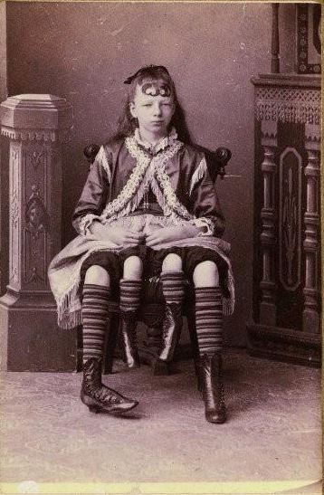 真实历史证明，近亲结婚后果很严重