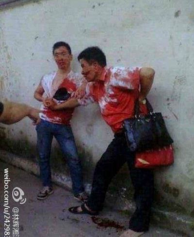 湖南衡东人大代表会后遭刀捅