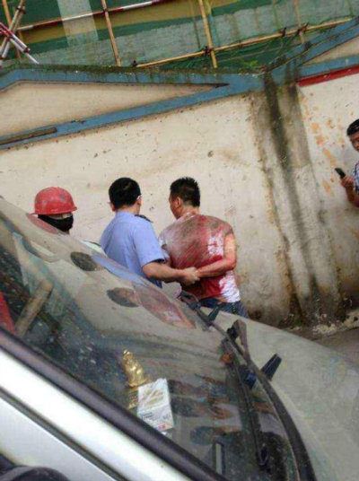 湖南衡东人大代表会后遭刀捅